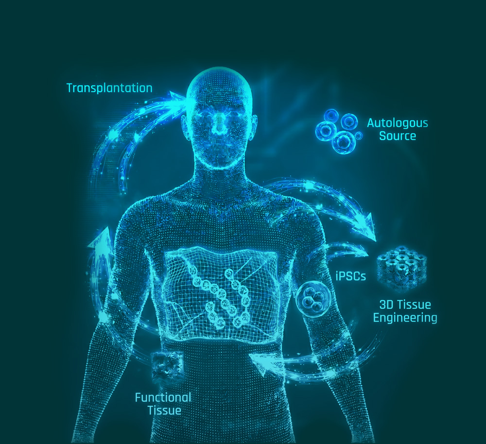 NVPX regenerative workflow: autologous source cells become iPSCs, are engineered into 3D tissue, and are transplanted as functional dopaminergic neural implant